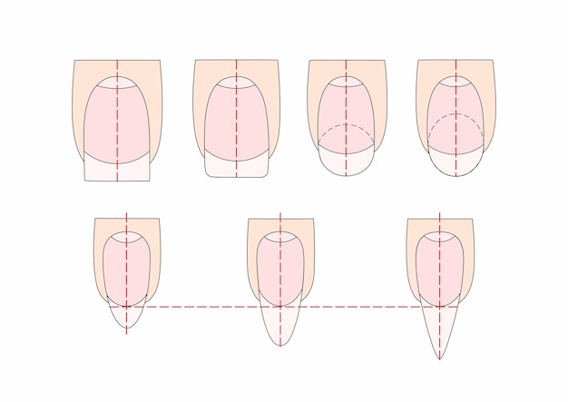 Схема этапов работы